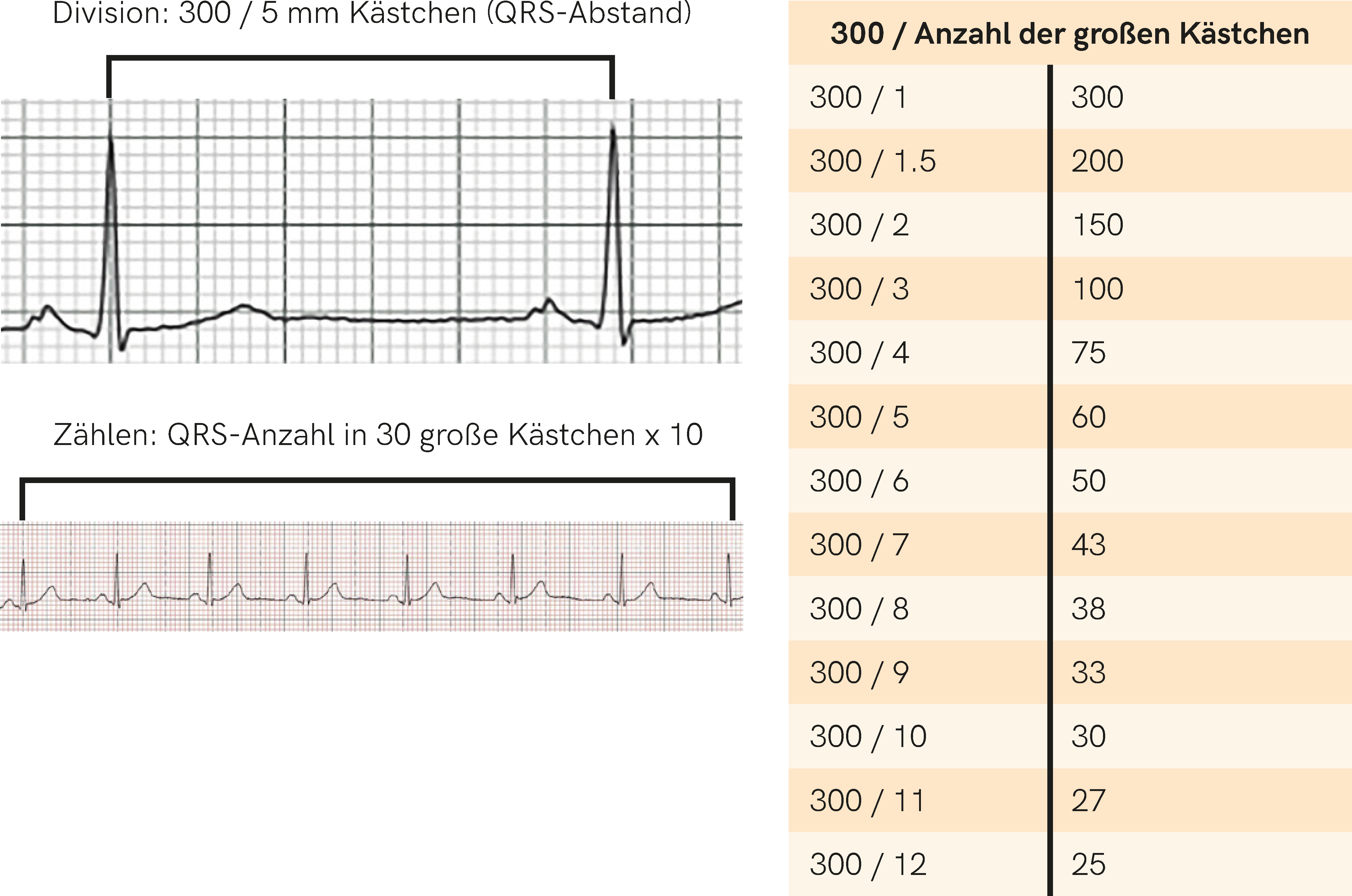 EKG Normwerte 2.png