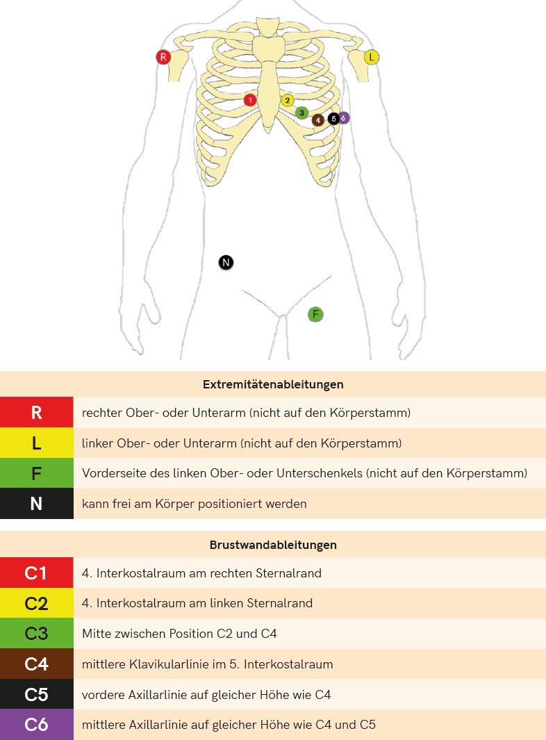 EKG Standardableitung.png